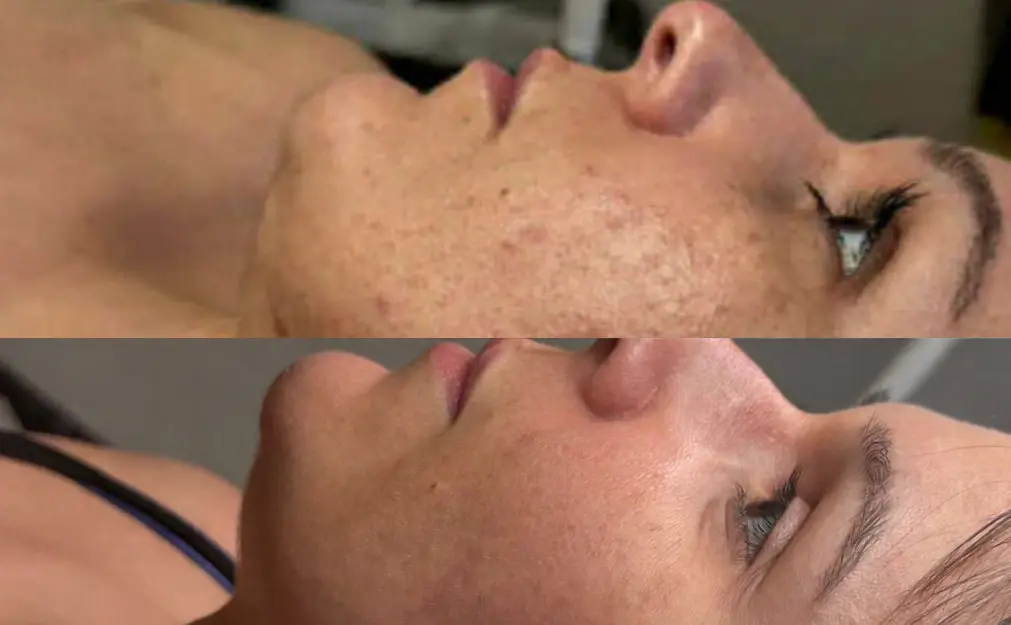 Résultat après plusieurs semaines avec le protocole Aurumaris